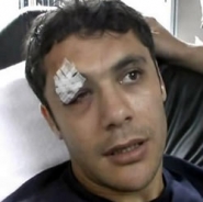 Ahmet Hassan kaza geçirdi