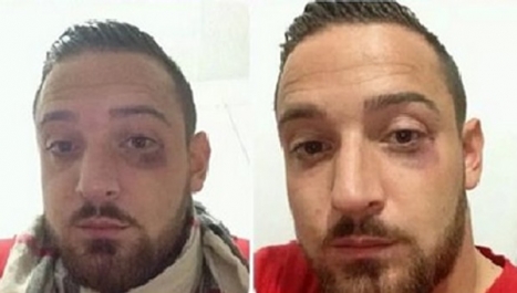 Deniz Naki'yi kim dövdü?