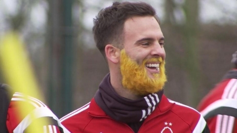 Danny Fox, kistik fibrozise dikkat çekmek için sakallarını boyadı