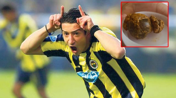 Serhat Akın'ın safra kesesinden bakın ne çıktı?