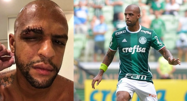 Felipe Melo'nun kaşı açıldı
